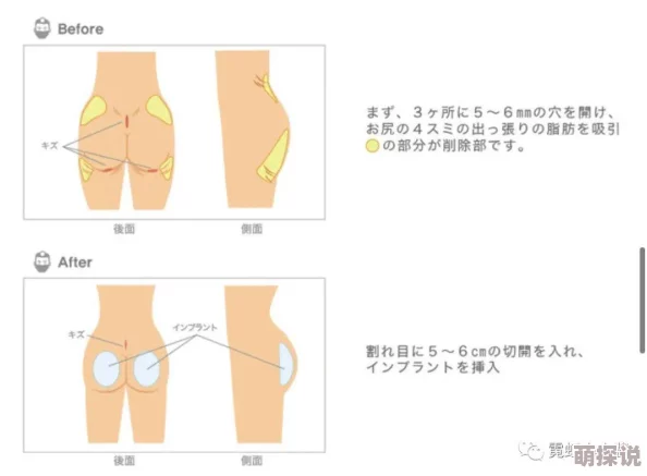 日本xxxx屁股xxxx日本文化中对身体部位的隐晦表达方式及其在流行文化中的应用