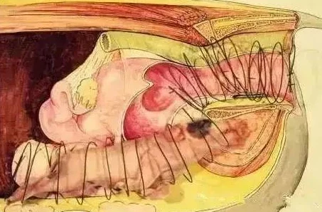 公猪钻入女人子宫会怎么样骇人听闻！兽交致子宫破裂女子身亡