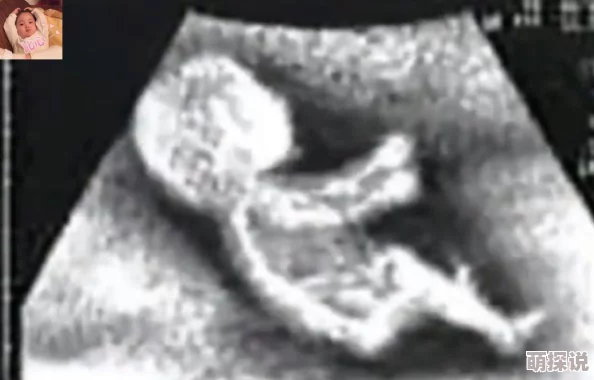 肚子里灌满男人们的尿h孕妇产检发现胎儿异常引网友热议